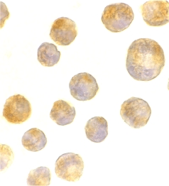 Immunocytochemistry of TLR4 in K562 cells with TLR4 antibody at 2 µg/ml.