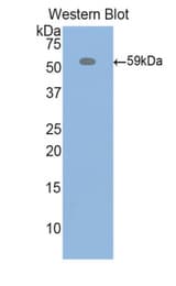 Western blot of recombinant ITIH4 / gp120.