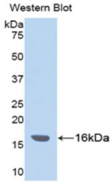 Western blot of recombinant ITIH4 / gp120.