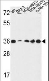 TOR1B Antibody western blot of 293,MCF-7,MDA-MB231,MDA-MB435,and mouse NIH-3T3 cell line lysates (35 ug/lane). The TOR1B antibody detected the TOR1B protein (arrow).