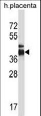 ITLN2 Antibody western blot of human placenta tissue lysates (35 ug/lane). The ITLN2 antibody detected the ITLN2 protein (arrow).