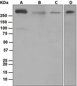 Western blot analysis on (A) rat brain, (B) SH-SY5Y, (C) mouse brain, and (D) HeLa lysates using anti-ITPR1 antibody.