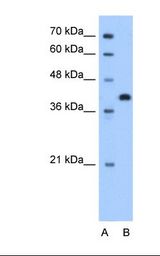 Lane A: Marker. Lane B: HepG2 cell lysate. Antibody concentration: 1.25 ug/ml. Gel concentration: 12%.