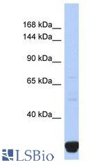 ITPR2 / IP3 Receptor antibody Western Blot of Fetal Small Intestine. Antibody dilution: 1 ug/ml.