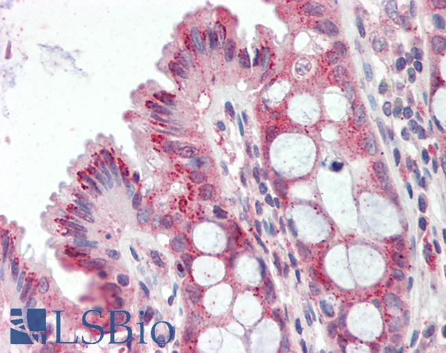 Anti-ITPR2 / IP3 Receptor antibody IHC staining of human colon. Immunohistochemistry of formalin-fixed, paraffin-embedded tissue after heat-induced antigen retrieval. Antibody LS-B9648 dilution 1:100.