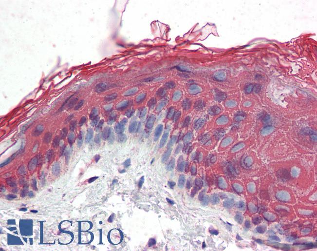 Anti-ITPR2 antibody IHC of human skin. Immunohistochemistry of formalin-fixed, paraffin-embedded tissue after heat-induced antigen retrieval. Antibody LS-B3238 concentration 75 ug/ml.