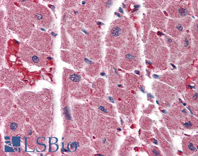 Anti-ITPR2 antibody IHC of human heart. Immunohistochemistry of formalin-fixed, paraffin-embedded tissue after heat-induced antigen retrieval. Antibody LS-B3238 concentration 75 ug/ml.