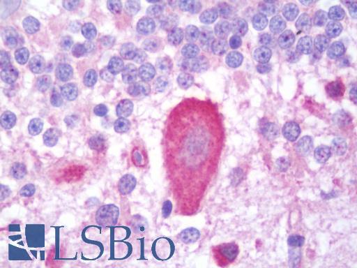 Anti-ITPR3 / IP3R antibody IHC staining of human brain, cerebellum. Immunohistochemistry of formalin-fixed, paraffin-embedded tissue after heat-induced antigen retrieval. Antibody LS-B11059 dilution 1:100.