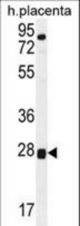 TOR2A Antibody western blot of human placenta tissue lysates (35 ug/lane). The TOR2A antibody detected the TOR2A protein (arrow).