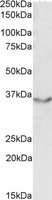 JAM2 antibody (0.5 ug/ml) staining of Human Heart lysate (35 ug protein/ml in RIPA buffer) with (B) and without (A) blocking with the immunizing peptide. Primary incubation was 1 hour. Detected by chemiluminescence.