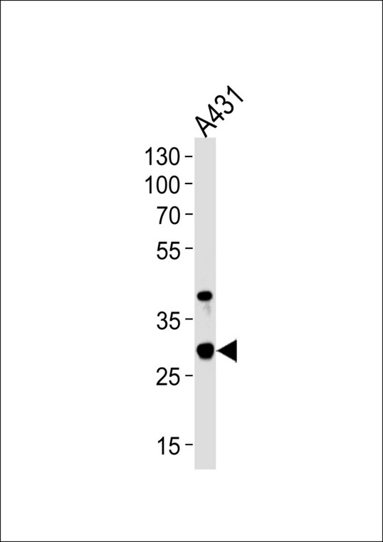 Western blot of lysate from A431 cell line, using JAM2 Antibody. Antibody was diluted at 1:1000 at each lane. A goat anti-rabbit IgG H&L (HRP) at 1:5000 dilution was used as the secondary antibody. Lysate at 35ug per lane.