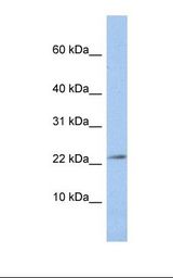 HepG2 cell lysate. Antibody concentration: 1.0 ug/ml. Gel concentration: 10-20%.