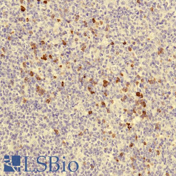 Immunohistochemistry of Human Tonsil stained with anti-J-chain antibody