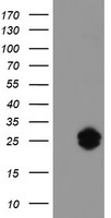 HEK293T cells were transfected with the pCMV6-ENTRY control (Left lane) or pCMV6-ENTRY IGJ (Right lane) cDNA for 48 hrs and lysed. Equivalent amounts of cell lysates (5 ug per lane) were separated by SDS-PAGE and immunoblotted with anti-IGJ.