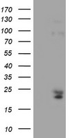 HEK293T cells were transfected with the pCMV6-ENTRY control (Left lane) or pCMV6-ENTRY IGJ (Right lane) cDNA for 48 hrs and lysed. Equivalent amounts of cell lysates (5 ug per lane) were separated by SDS-PAGE and immunoblotted with anti-IGJ.