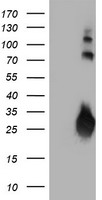 HEK293T cells were transfected with the pCMV6-ENTRY control (Left lane) or pCMV6-ENTRY IGJ (Right lane) cDNA for 48 hrs and lysed. Equivalent amounts of cell lysates (5 ug per lane) were separated by SDS-PAGE and immunoblotted with anti-IGJ.