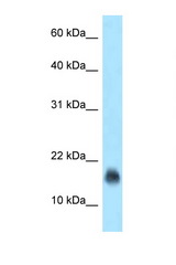 IGJ antibody LS-C146040 Western blot of Jurkat Cell lysate. Antibody concentration 1 ug/ml.