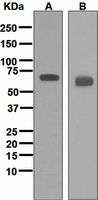 Western blot analysis on (A) human spleen and (B) fetal lung lysates using anti-TOSO / FAIM3 antibody.