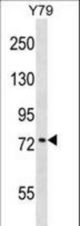 KATNB1 Antibody western blot of Y79 cell line lysates (35 ug/lane). The KATNB1 antibody detected the KATNB1 protein (arrow).