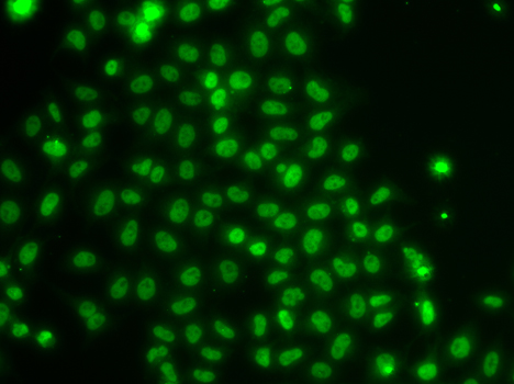 Immunofluorescence blot of U20S cell using TOX antibody.