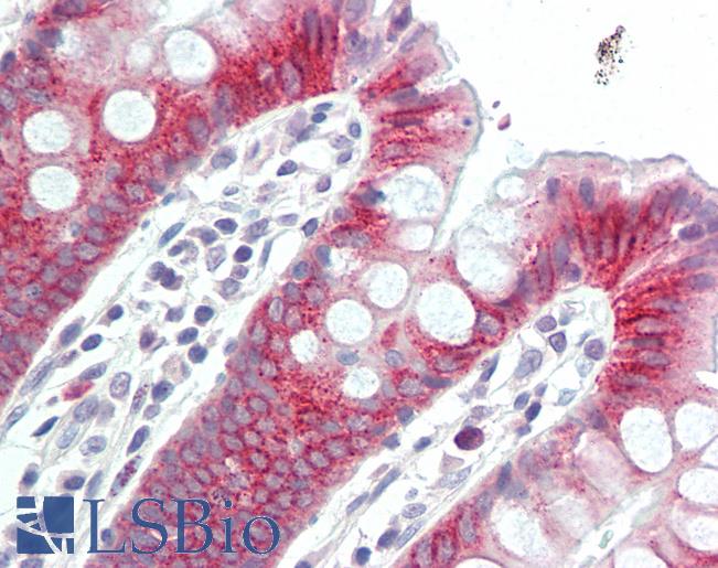 Anti-TOX antibody IHC staining of human colon. Immunohistochemistry of formalin-fixed, paraffin-embedded tissue after heat-induced antigen retrieval.