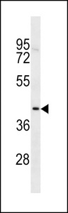TOX2 Antibody western blot of MDA-MB231 cell line lysates (35 ug/lane). The TOX2 antibody detected the TOX2 protein (arrow).