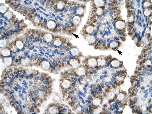 TOX2 / C20orf100 antibody LS-C29895 was used in IHC to stain formalin-fixed, paraffin-embedded human intestine.