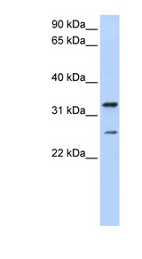 KCNIP2 / KCHIP2 antibody western blot of Jurkat cell lysate.