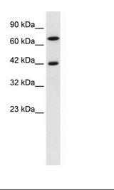 Jurkat Cell Lysate