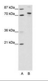 A: Marker, B: Transfected 293T Cell Lysate