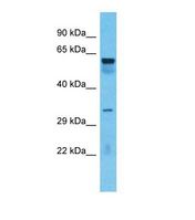 Western blot of Human Lung tumor . TOX4 antibody dilution 1.0 ug/ml.