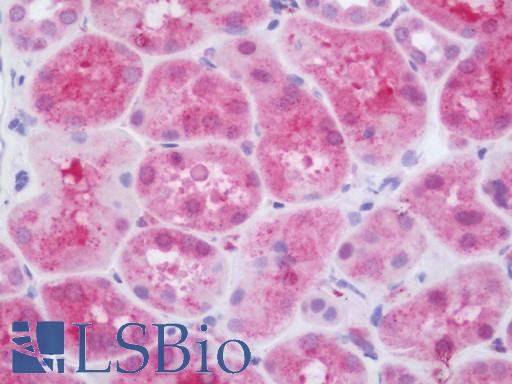 Human Kidney: Formalin-Fixed, Paraffin-Embedded (FFPE)