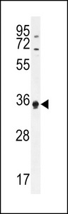 ECAT1 Antibody western blot of HL-60 cell line lysates (35 ug/lane). The ECAT1 antibody detected the ECAT1 protein (arrow).