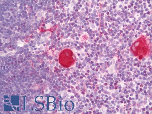 Human Thymus: Formalin-Fixed, Paraffin-Embedded (FFPE)