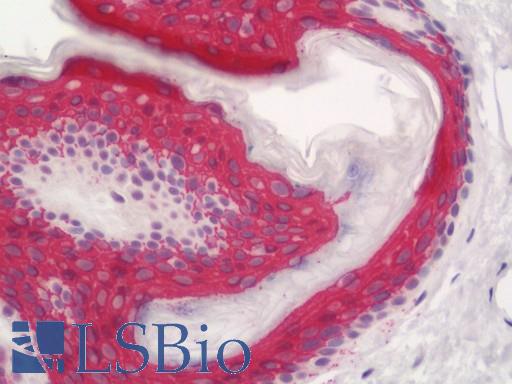 Human Skin: Formalin-Fixed, Paraffin-Embedded (FFPE)