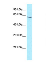 KIAA1279 antibody LS-C146006 Western blot of HT1080 Cell lysate. Antibody concentration 1 ug/ml.