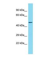Western blot of Mouse Thymus. Kbp antibody dilution 1.0 ug/ml.
