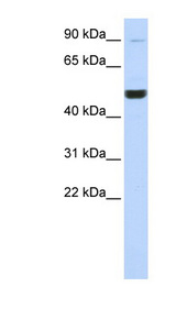KIF2A antibody LS-C109842 Western blot of 721_B cell lysate.