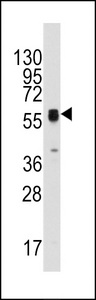 Western blot of anti-ECGF1 antibody in HepG2 cell line lysates (35 ug/lane). ECGF1(arrow) was detected using the purified antibody.