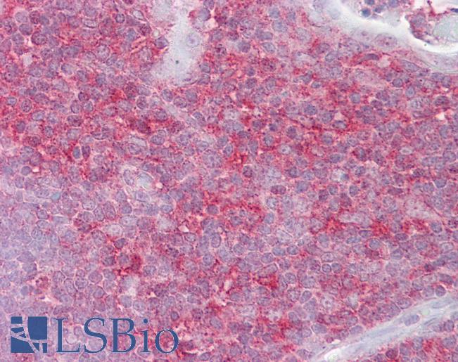 Anti-KIF2A antibody IHC of human thymus. Immunohistochemistry of formalin-fixed, paraffin-embedded tissue after heat-induced antigen retrieval. Antibody LS-B6538 concentration 5 ug/ml.