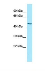 Western blot of Human Hela. KIR3DL2 antibody dilution 1.0 ug/ml.