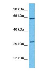 Western blot of KLC1 Antibody with human MCF7 Whole Cell lysate.