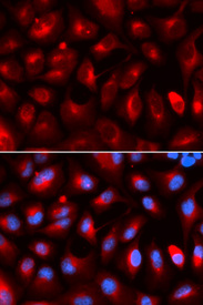 Immunofluorescence analysis of U20S cell using KLC1 antibody. Blue: DAPI for nuclear staining.