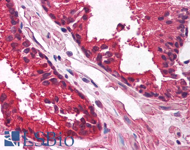 Anti-KLF6 antibody IHC of human prostate. Immunohistochemistry of formalin-fixed, paraffin-embedded tissue after heat-induced antigen retrieval. Antibody LS-B1544 concentration 5 ug/ml.