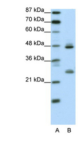 KLF6 antibody LS-B1544 Western blot of Transfected 293T cell lysate.