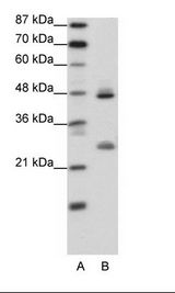 A: Marker, B: Transfected 293T Cell Lysate