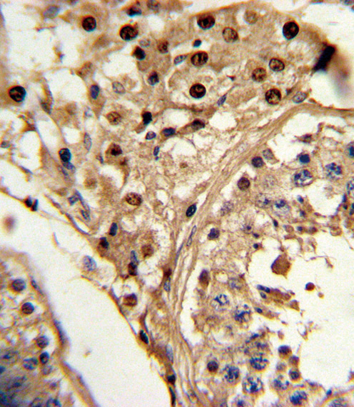 Formalin-fixed and paraffin-embedded human testis tissue reacted with KLF6 Antibody , which was peroxidase-conjugated to the secondary antibody, followed by DAB staining. This data demonstrates the use of this antibody for immunohistochemistry; clinical relevance has not been evaluated.