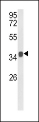Western blot of KLF6 Antibody in mouse stomach tissue lysates (35 ug/lane). KLF6 (arrow) was detected using the purified antibody.