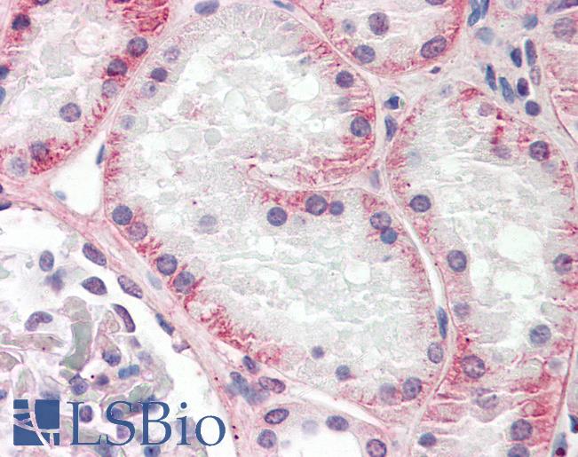 Anti-KLHL1 / MRP2 antibody IHC staining of human kidney. Immunohistochemistry of formalin-fixed, paraffin-embedded tissue after heat-induced antigen retrieval. Antibody LS-B9811 dilution 1:100.