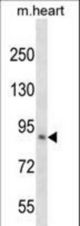 KLHL1 Antibody western blot of mouse heart tissue lysates (35 ug/lane). The KLHL1 antibody detected the KLHL1 protein (arrow).